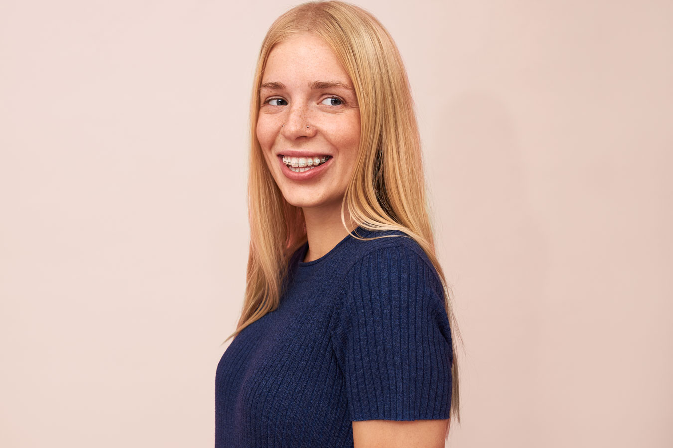 Adult patient with traditional braces Adult orthodontic patient wearing traditional metal braces during treatment